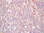 MT-ND5 Antibody in Immunohistochemistry (Paraffin) (IHC (P))