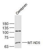 MT-ND5 Antibody in Western Blot (WB)