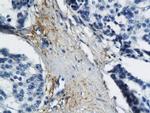 MT-ND6 Antibody in Immunohistochemistry (Paraffin) (IHC (P))