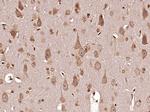MT-ND6 Antibody in Immunohistochemistry (Paraffin) (IHC (P))
