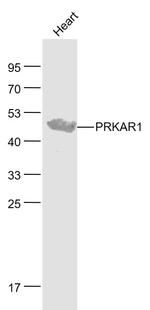 PRKAR1 Antibody in Western Blot (WB)