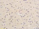 SDHD Antibody in Immunohistochemistry (Paraffin) (IHC (P))