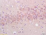ENO3 Antibody in Immunohistochemistry (Paraffin) (IHC (P))