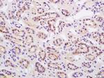 Phospho-HER2 (Thr686) Antibody in Immunohistochemistry (Paraffin) (IHC (P))