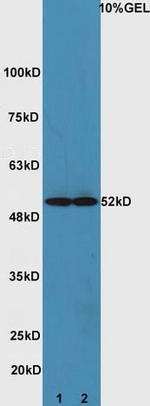ATG4D Antibody in Western Blot (WB)