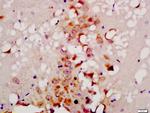 ATG9B Antibody in Immunohistochemistry (Paraffin) (IHC (P))