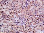 ATG3 Antibody in Immunohistochemistry (Paraffin) (IHC (P))