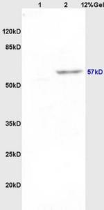 Pancreatic Amylase Antibody in Western Blot (WB)