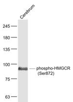 Phospho-HMGCR (Ser872) Antibody in Western Blot (WB)