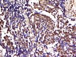 Phospho-CBL2 (Tyr700) Antibody in Immunohistochemistry (Paraffin) (IHC (P))