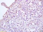Phospho-E2F1 (Ser364) Antibody in Immunohistochemistry (Paraffin) (IHC (P))