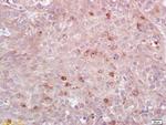 HLA-DPB1 Antibody in Immunohistochemistry (Paraffin) (IHC (P))