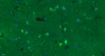 GABA A Receptor gamma 2 Antibody in Immunohistochemistry (Paraffin) (IHC (P))