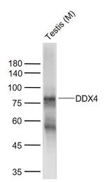 DDX4 Antibody in Western Blot (WB)