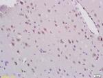 MEK5 Antibody in Immunohistochemistry (Paraffin) (IHC (P))