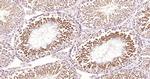 MEK5 Antibody in Immunohistochemistry (Paraffin) (IHC (P))