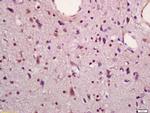 MAPKAPK5 Antibody in Immunohistochemistry (Paraffin) (IHC (P))