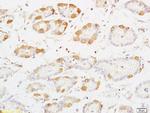 PRKD3 Antibody in Immunohistochemistry (Paraffin) (IHC (P))