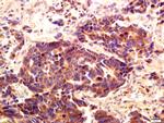PI 3 Kinase Class 3 Antibody in Immunohistochemistry (Paraffin) (IHC (P))