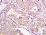 TRIM25 Antibody in Immunohistochemistry (Paraffin) (IHC (P))