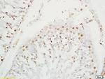 SOX9 Antibody in Immunohistochemistry (Paraffin) (IHC (P))