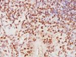 RPA32 Antibody in Immunohistochemistry (Paraffin) (IHC (P))