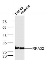 RPA32 Antibody in Western Blot (WB)
