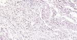 RelB Antibody in Immunohistochemistry (Paraffin) (IHC (P))