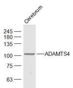 ADAMTS4 Antibody in Western Blot (WB)