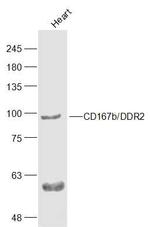 CD167b Antibody in Western Blot (WB)
