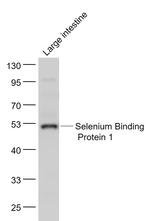Selenium Binding Protein 1 Antibody in Western Blot (WB)