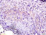 GEF H1 Antibody in Immunohistochemistry (Paraffin) (IHC (P))