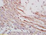 VLDL Receptor Antibody in Immunohistochemistry (Paraffin) (IHC (P))