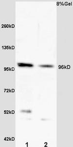 VLDL Receptor Antibody in Western Blot (WB)