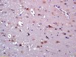 ABAT Antibody in Immunohistochemistry (Paraffin) (IHC (P))