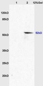 GLUT8 Antibody in Western Blot (WB)
