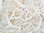 P2X3 Antibody in Immunohistochemistry (Paraffin) (IHC (P))