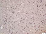 XPB Antibody in Immunohistochemistry (Paraffin) (IHC (P))