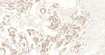 XPB Antibody in Immunohistochemistry (Paraffin) (IHC (P))