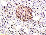 TBRG1 Antibody in Immunohistochemistry (Paraffin) (IHC (P))