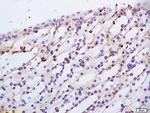 TBRG1 Antibody in Immunohistochemistry (Paraffin) (IHC (P))