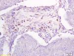 DBC2 Antibody in Immunohistochemistry (Paraffin) (IHC (P))