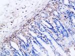 DBC2 Antibody in Immunohistochemistry (Paraffin) (IHC (P))