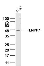 ENPP7 Antibody in Western Blot (WB)