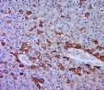 FAT Antibody in Immunohistochemistry (Paraffin) (IHC (P))