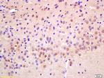 RAD21 Antibody in Immunohistochemistry (Paraffin) (IHC (P))