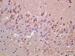 VAV3 Antibody in Immunohistochemistry (Paraffin) (IHC (P))