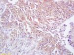 CDC37 Antibody in Immunohistochemistry (Paraffin) (IHC (P))