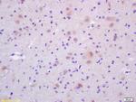 CDC37 Antibody in Immunohistochemistry (Paraffin) (IHC (P))