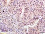 BARD1 Antibody in Immunohistochemistry (Paraffin) (IHC (P))